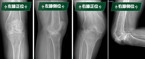 By6E9zMVnF7fPfa8.png image.png