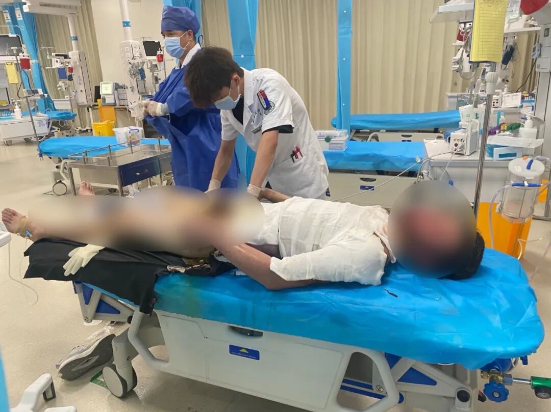 27500伏高壓電擊全身燒傷，20歲小伙的88天重生路